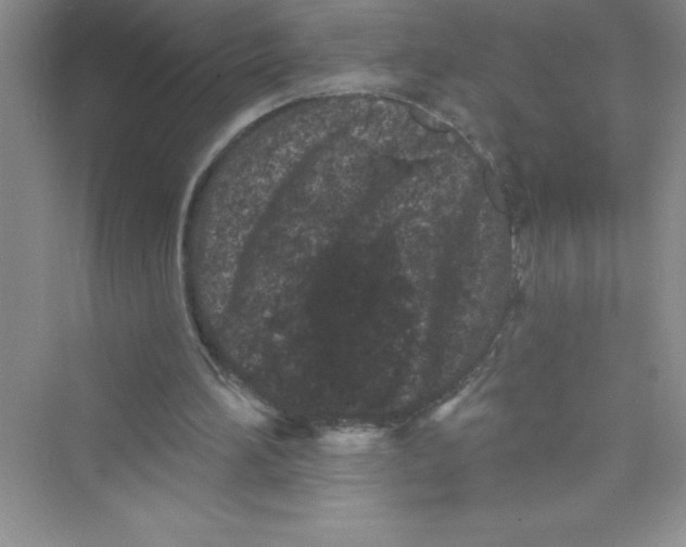 X0000072540196200608111822