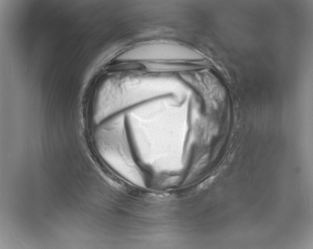 X0000072540245200608111820