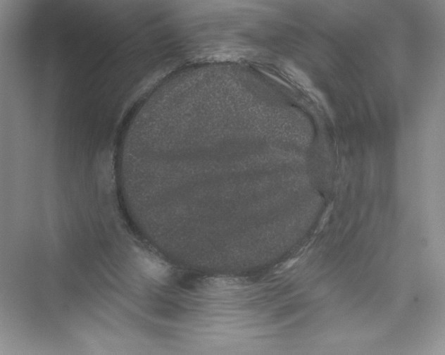 X0000072540250200608111820