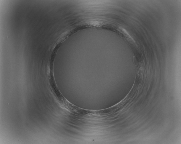 X0000072540500200608111816