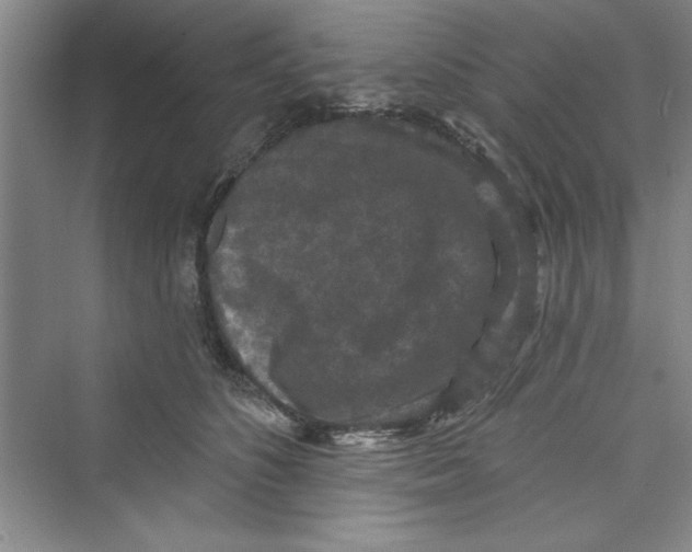 X0000072540516200608111816