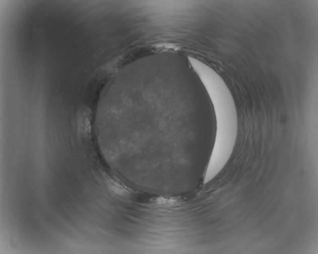 X0000072540570200608111816