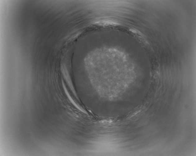 X0000072541014200608111807