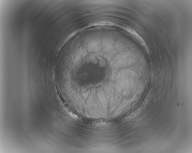 X0000072550945200608111835