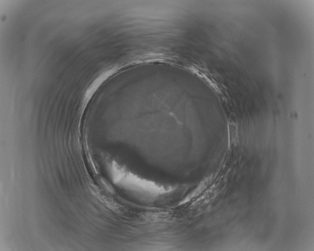 X0000072920147200608111519