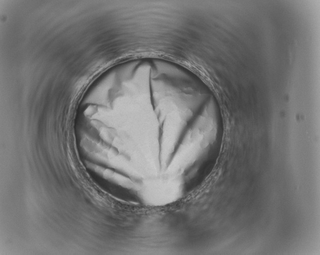 X0000072940145200608111609