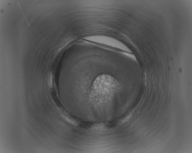 X0000072950076200608181417
