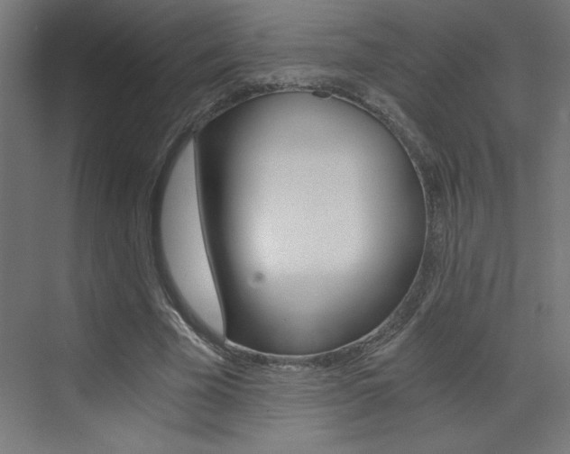 X0000072960585200607211007