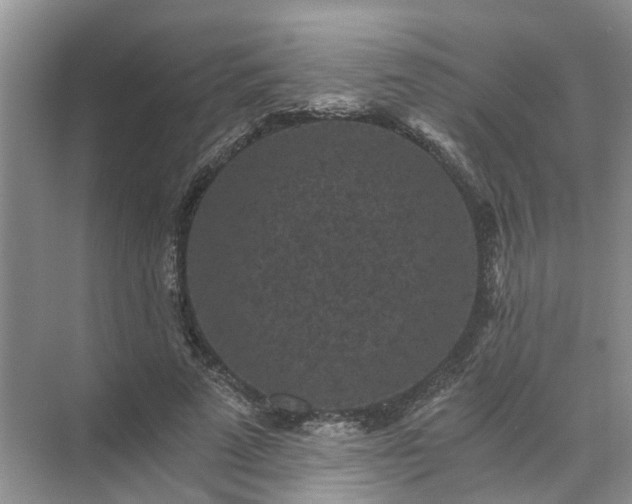 X0000072960689200607282256