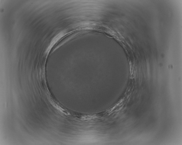 X0000072960099200608041203