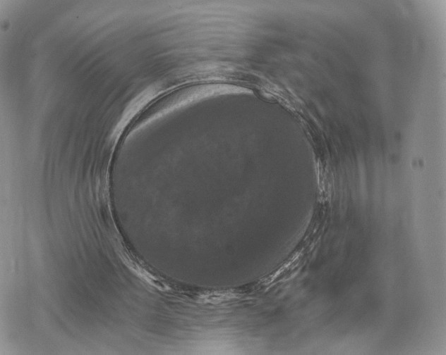 X0000072960099200608111701