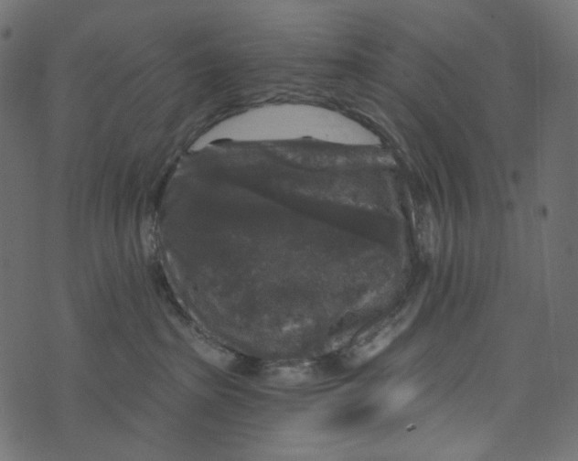 X0000072960285200608181439