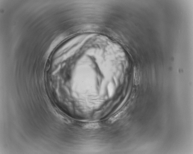 X0000072990099200608111817