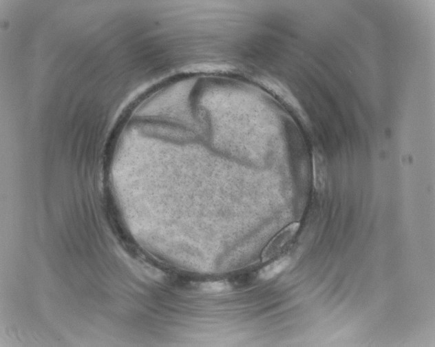 X0000072990204200608111815