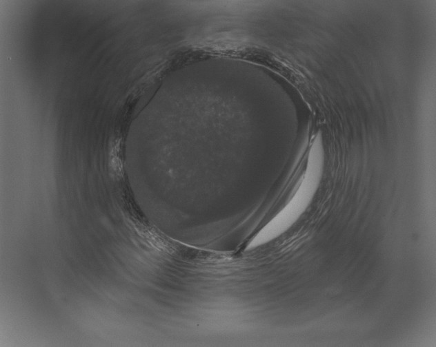 X0000073401156200608181022