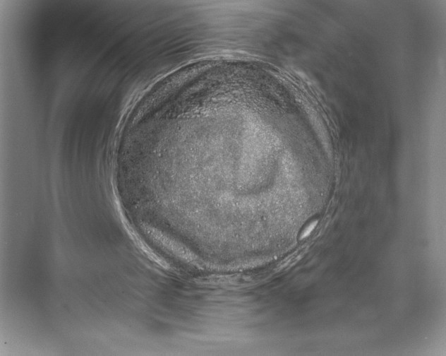 X0000073420049200608111401