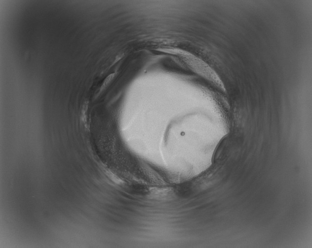 X0000073420185200608181130