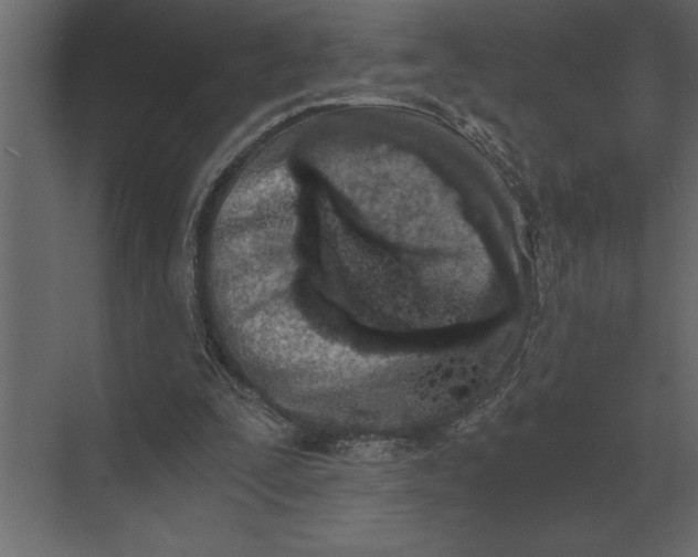 X0000073450295200608181246