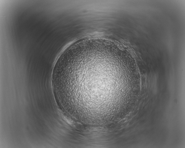 X0000073520147200608141009