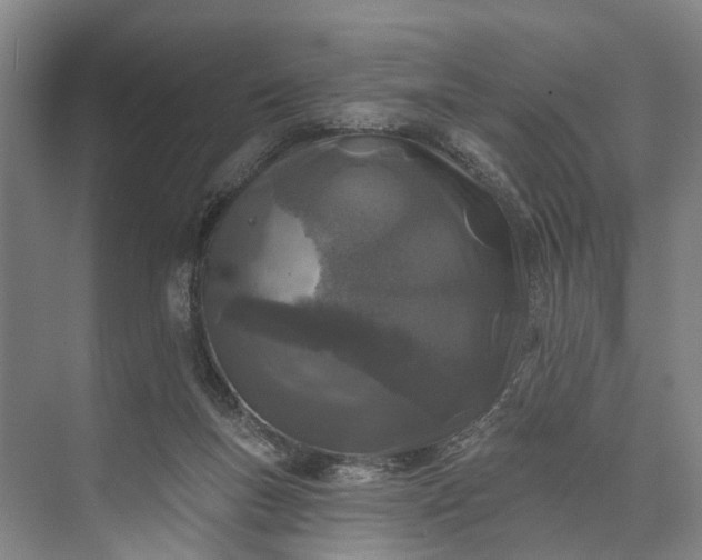 X0000073520167200608141009