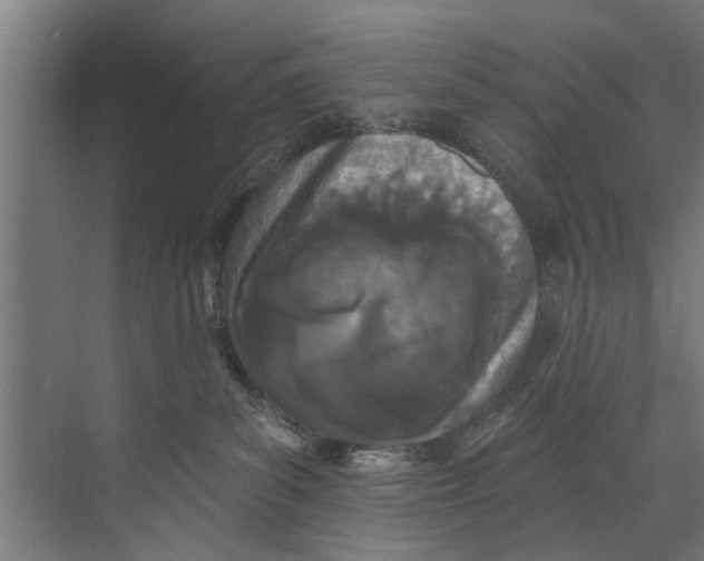 X0000073520139200608281743