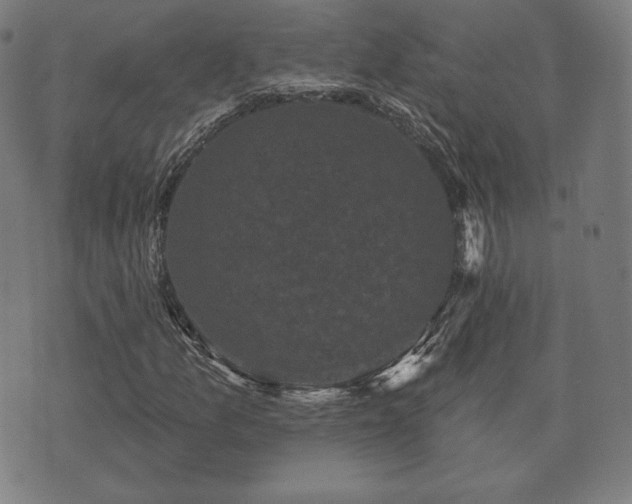 X0000073541157200608071048