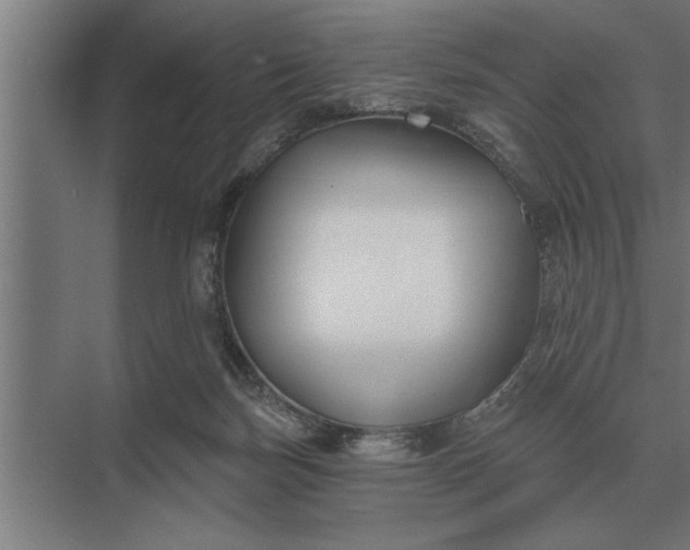 X0000073540171200608141101