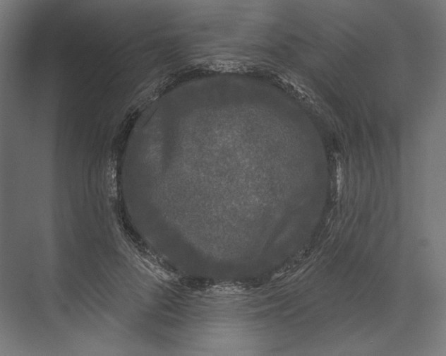 X0000073710696200608241443