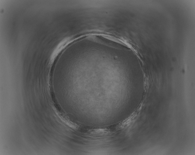 X0000073720151200608171212