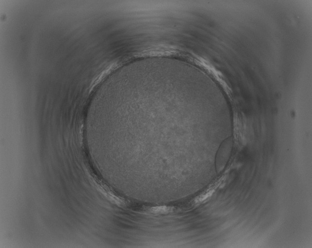 X0000073720153200608171212