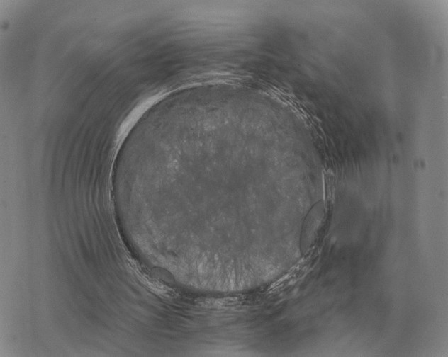 X0000073720147200608311828