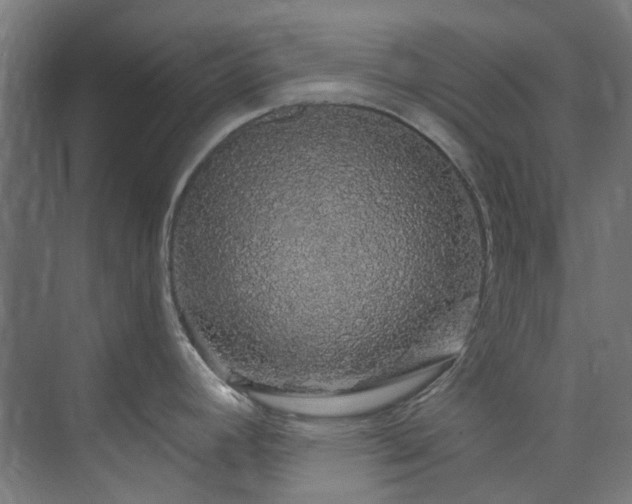 X0000073851392200608171021