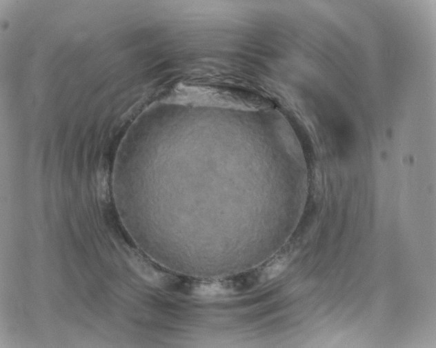 X0000073920177200608111231