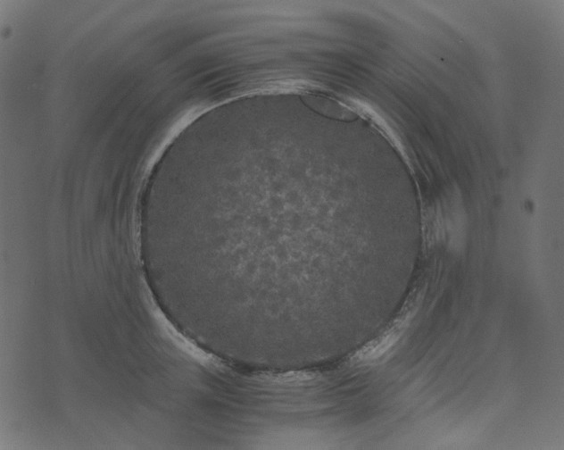 X0000073920851200608181047