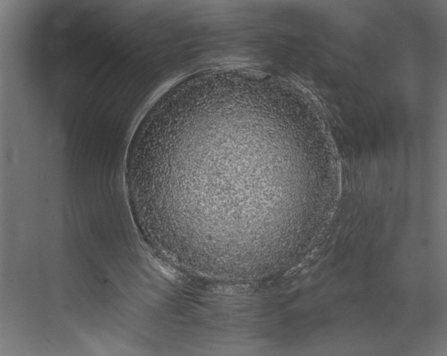 X0000073920147200608251558