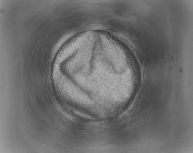 X0000073920147200609082246