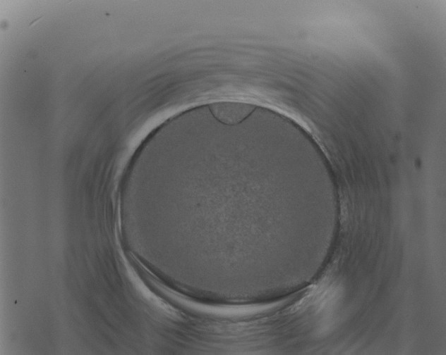 X0000073931515200608181101