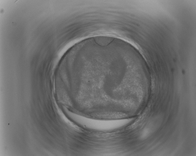 X0000073931515200609082250