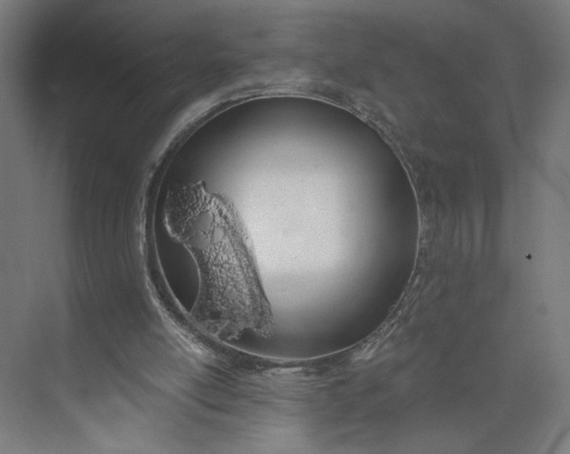 X0000073950054200609051803