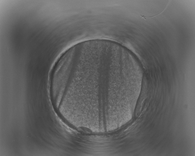 X0000073981508200609181703