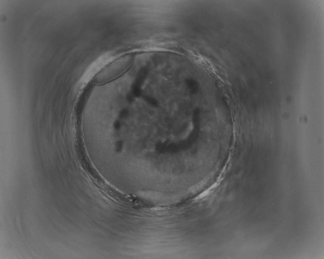 X0000073990295200609111540