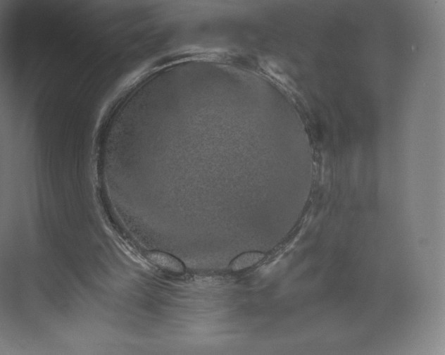 X0000074000149200609061032