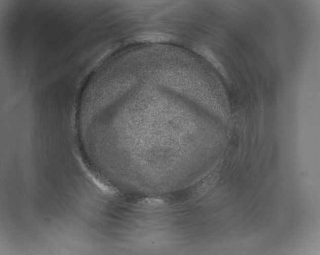 X0000074000159200609061033