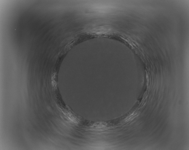 X0000074011156200608281358