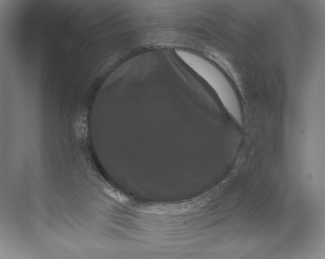 X0000074010017200609061101