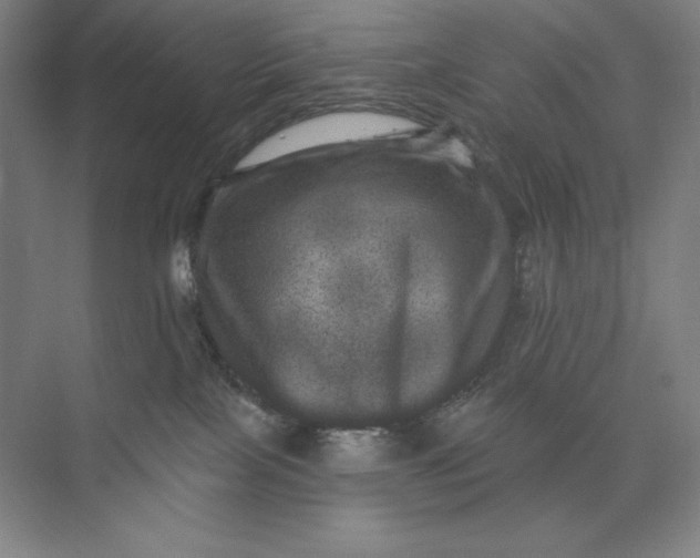 X0000074010089200609061101