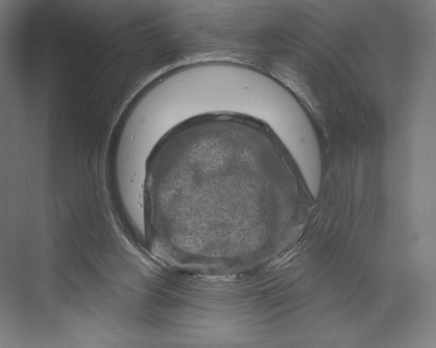 X0000074010156200609061058