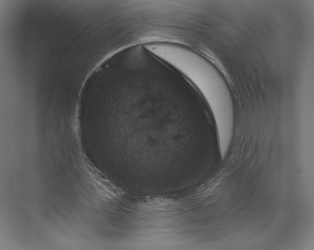 X0000074010387200609061055