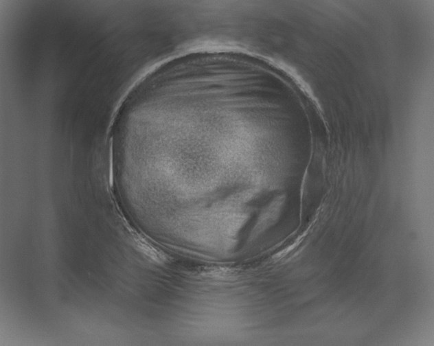 X0000074011175200609061042