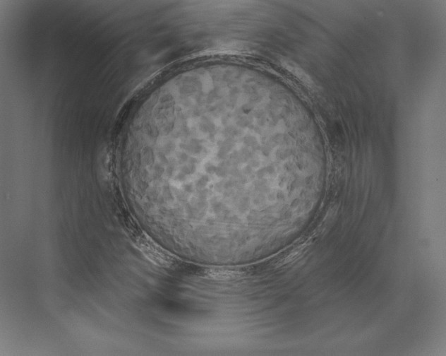 X0000074011258200609061040